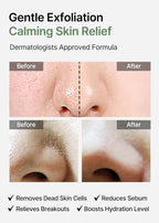 [Celimax] Ji.Woo.Gae Heartleaf BHA Peeling Pad 160pad (80pad x 2)